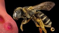 Cancer du sein : la nouvelle molécule qui fait le buzz
